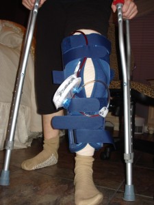 Knee-Drain